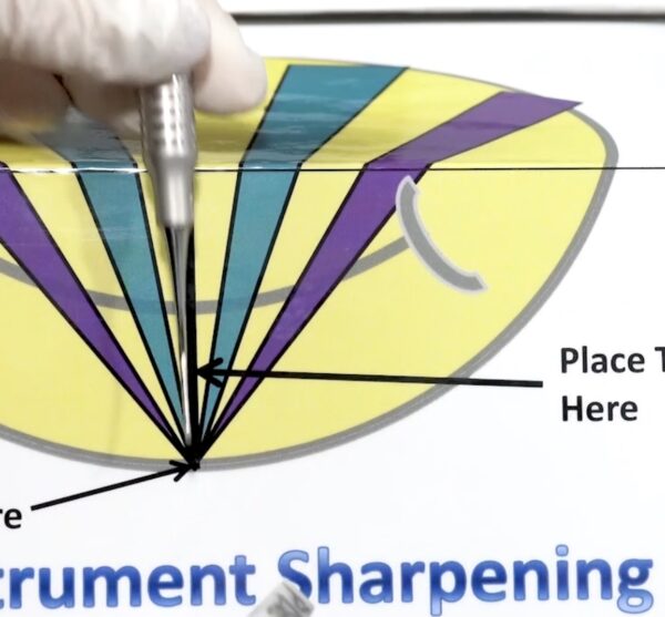 Hand-Instrument Sharpening Video-Universal Curette - Image 2